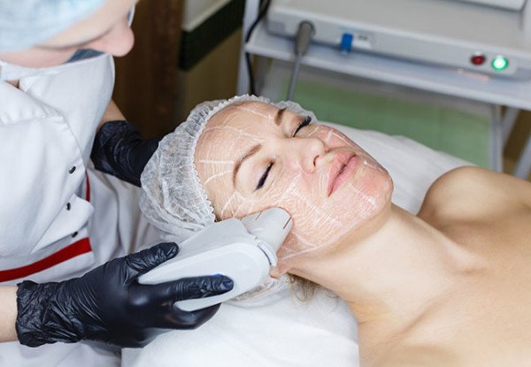 SMAS lifting Ultrasound