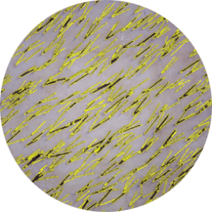 Trichoscan-Trichogramm